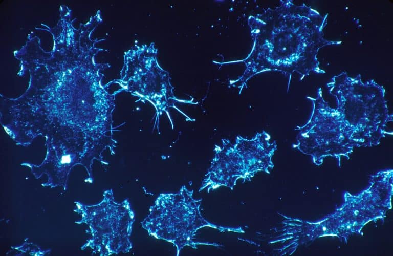 This Protein Stops the Growth of Prostate Cancer Cells