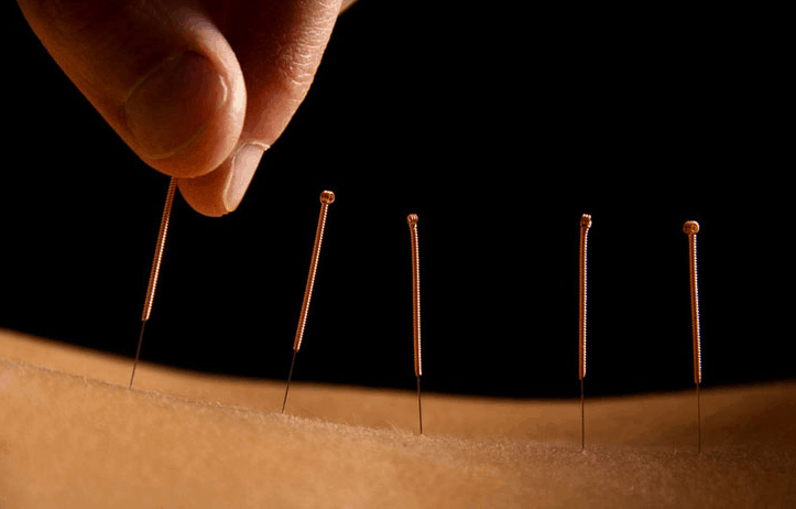 prostatitis acupuncture